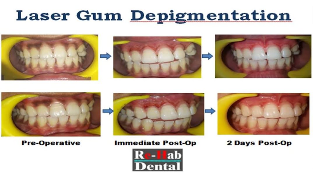 Dentist Near Me - Best Dental Clinic - Top implant Dentist in Noida, Delhi NCR | Dental Implant Specialist in Noida