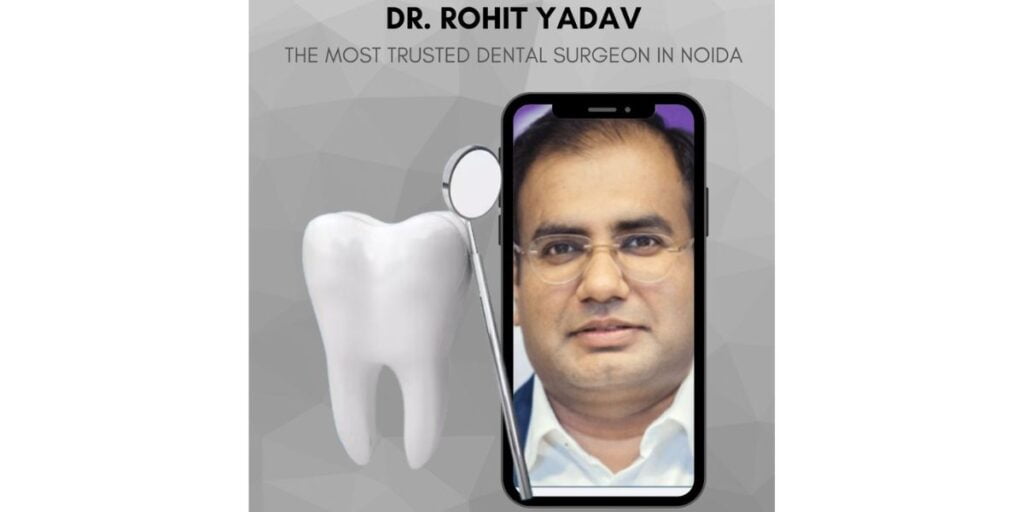 How to Choose a Dentist for Dental Implant?