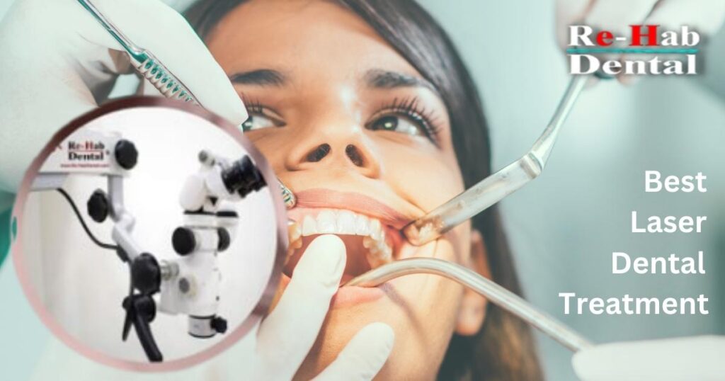 Benefits of Laser Assisted RCT