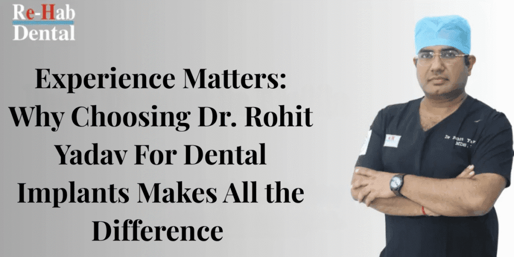 Experience Matters: Why Choosing Dr. Rohit Yadav For Dental Implants Makes All the Difference