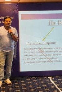 Rohit Yadav Dentist Corticobasal Implantologist Noida 4 640x296