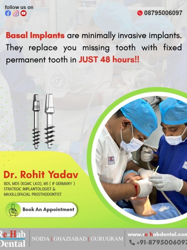 Immediate Loading Dental Implants: Your Fast Track to a Perfect Smile