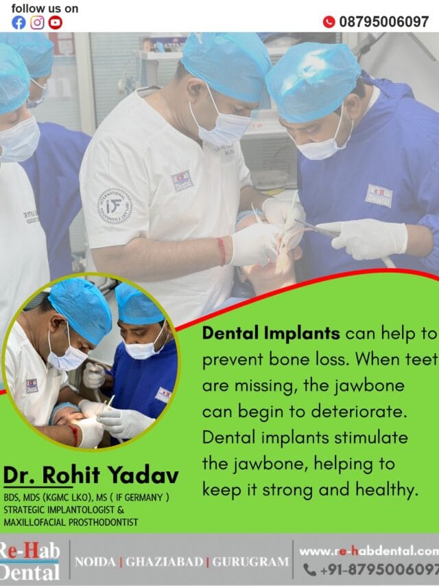 Did You Know? Dental Implants Can Stop Bone Loss