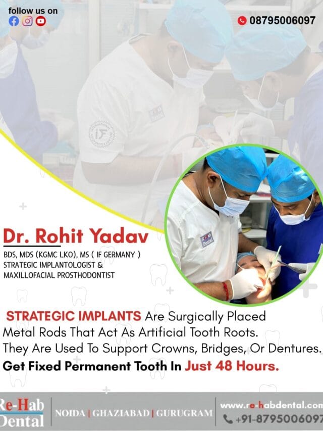 Meet Dr. Rohit Yadav – The Best Implant Surgeon for Permanent Teeth Solutions