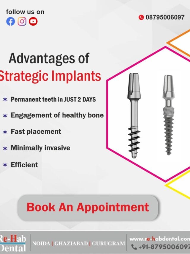 Immediate Implants: Get Fixed Teeth in Just 48 Hours!