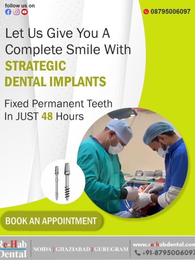 Strategic Dental Implants: The Fastest Way to Restore Your Smile Without Bone Grafting